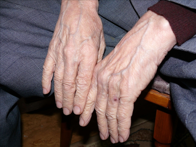 Elderly_Hands.jpg Elderly_Hands.jpg