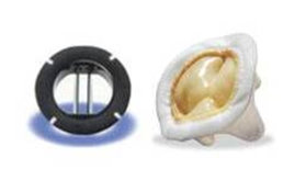 Heart_Valves.jpg